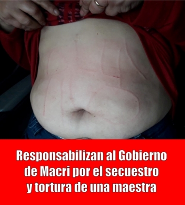 Crece la tensión entre el gobierno y los gremios: Secuestran y torturan a una maestra Crece la tensión entre el gobierno y los gremios: Secuestran y torturan a una maestra